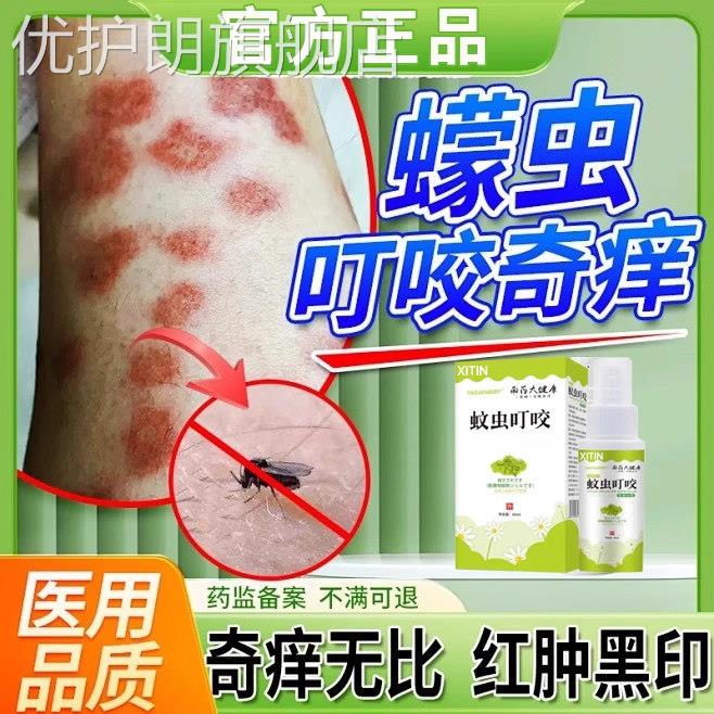 蠓虫叮咬药膏咬伤止痒消肿膏小咬克星驱蚊水防蚊虫叮咬咬伤喷剂UU