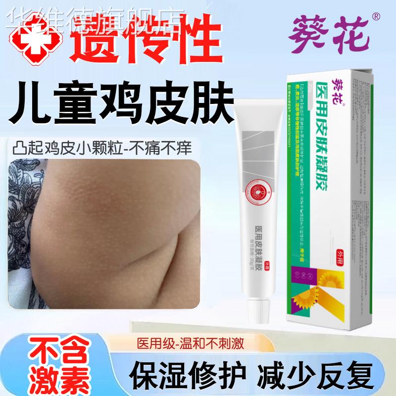 儿童鸡皮肤疙瘩毛囊角化症毛周神器去除膏全身手臂腿脸部药监备案