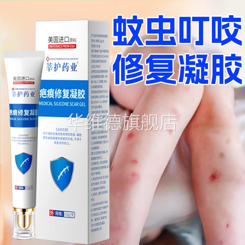 蚊虫叮咬祛疤膏去疤印去黑色素沉淀儿童祛黑印去蚊子印疤痕修复华