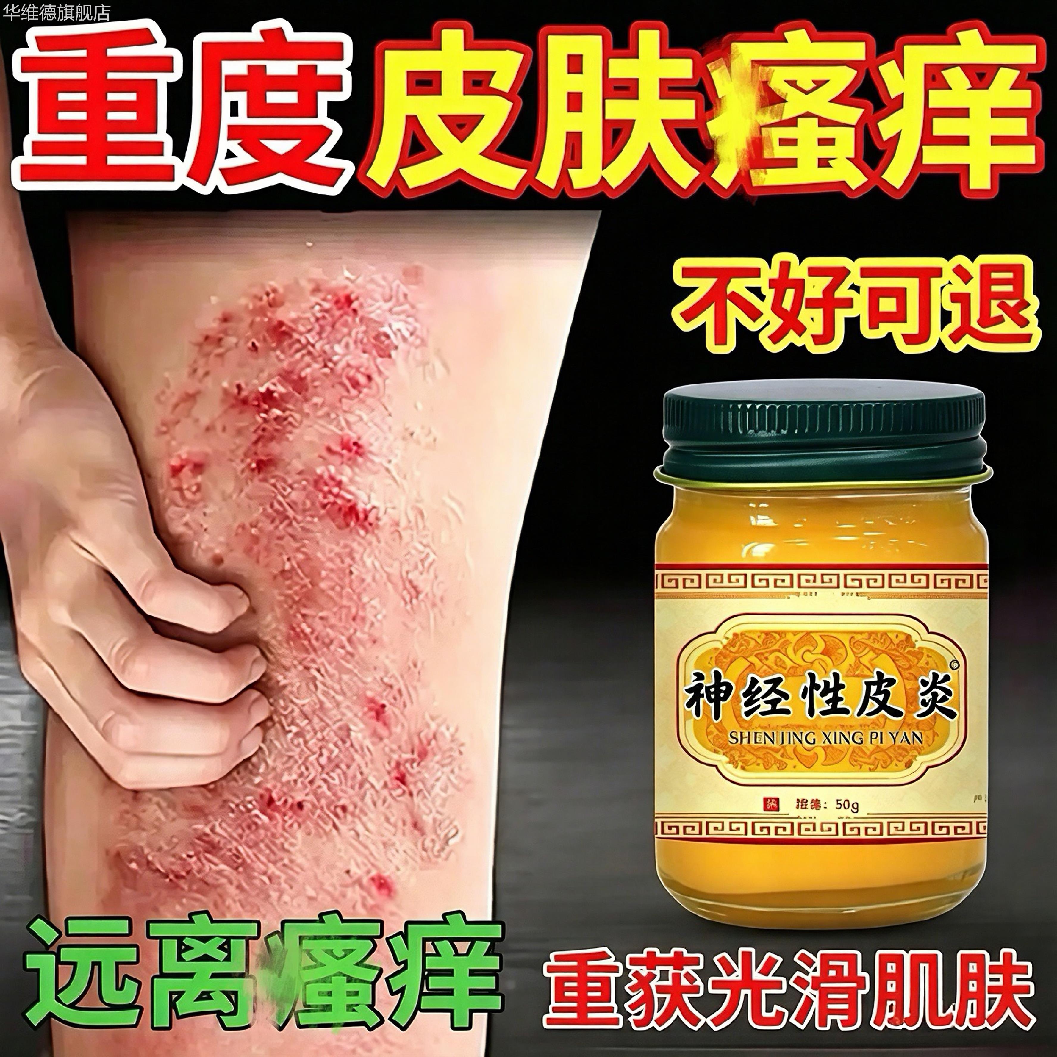 神经性皮炎特祛去除效外用药膏顽固根无激素除皮肤痒藓止真菌感染