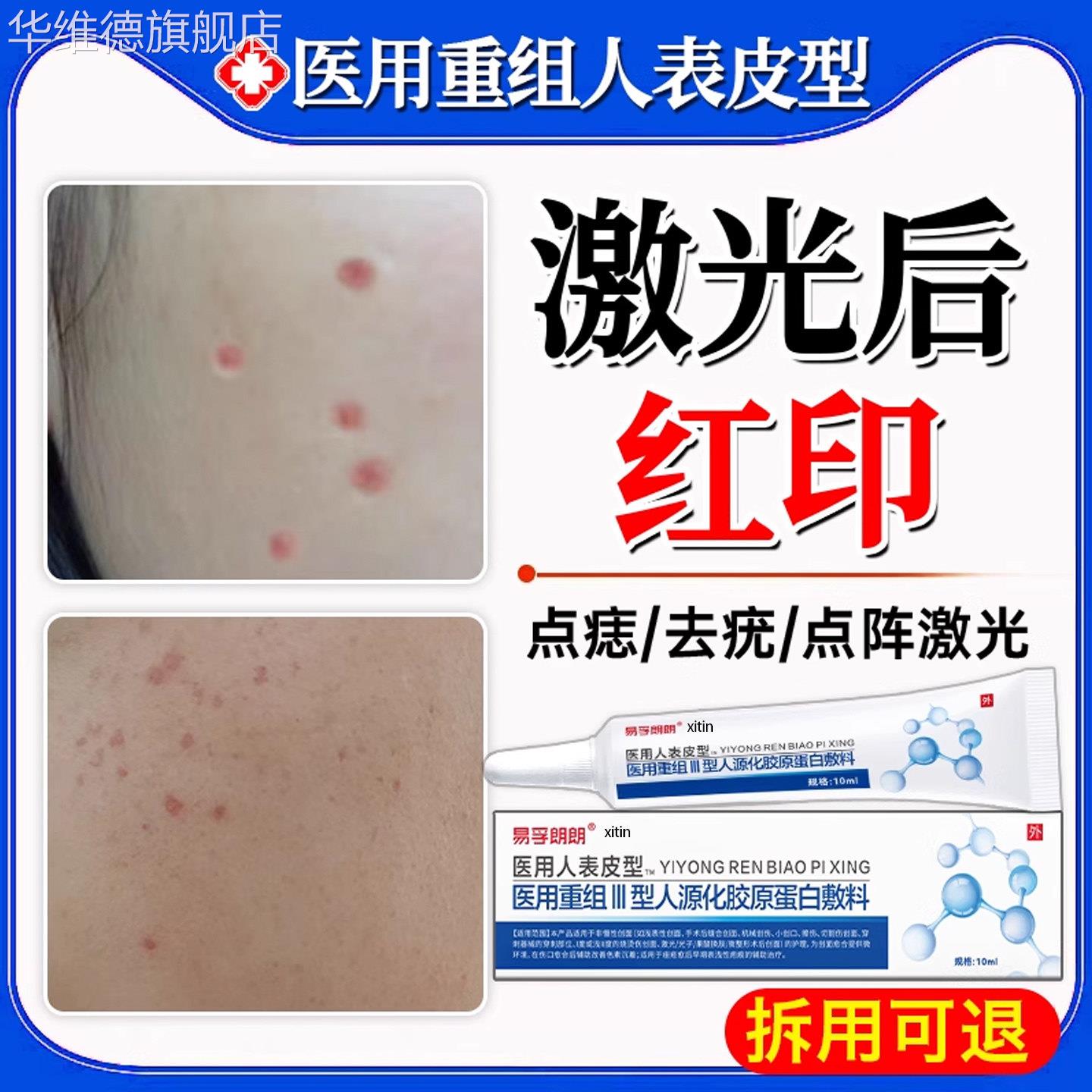 祛痣激光祛斑术后点痣后修复膏产品去红印黑印退红淡印消印疤痕TT
