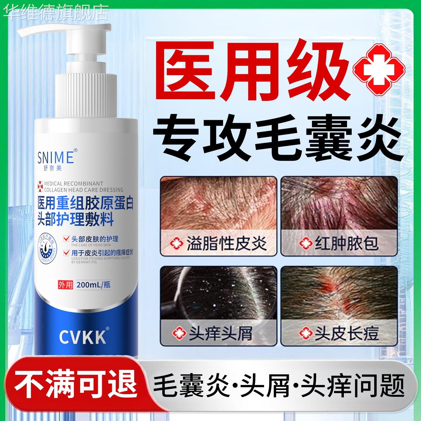 毛囊炎洗发水脂溢性皮炎抑菌真菌感染头癣头皮溢脂性皮炎洗发水华