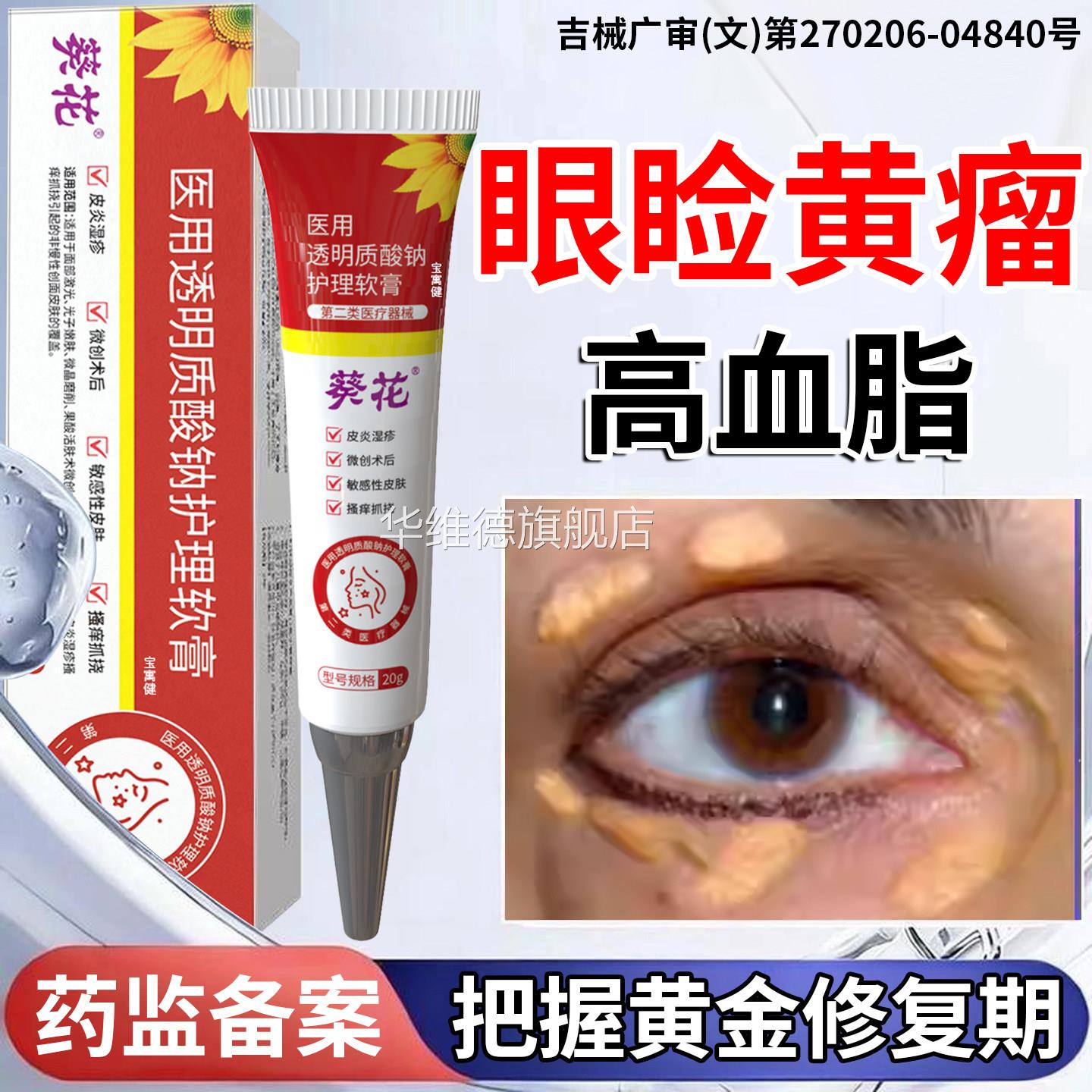 高睑黄瘤去除神器眼睑黄瘤疣去眼皮黄斑瘤疣专用膏血脂眼部脂肪粒