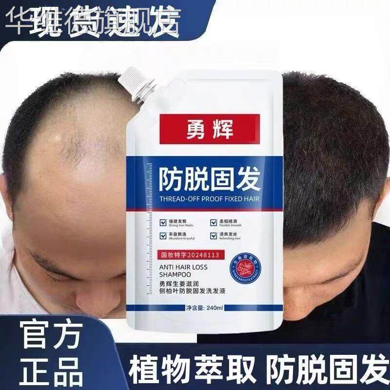 上官博士苗坚勇辉防脱液洗发水发精华正品官方品牌旗舰店生姜华维