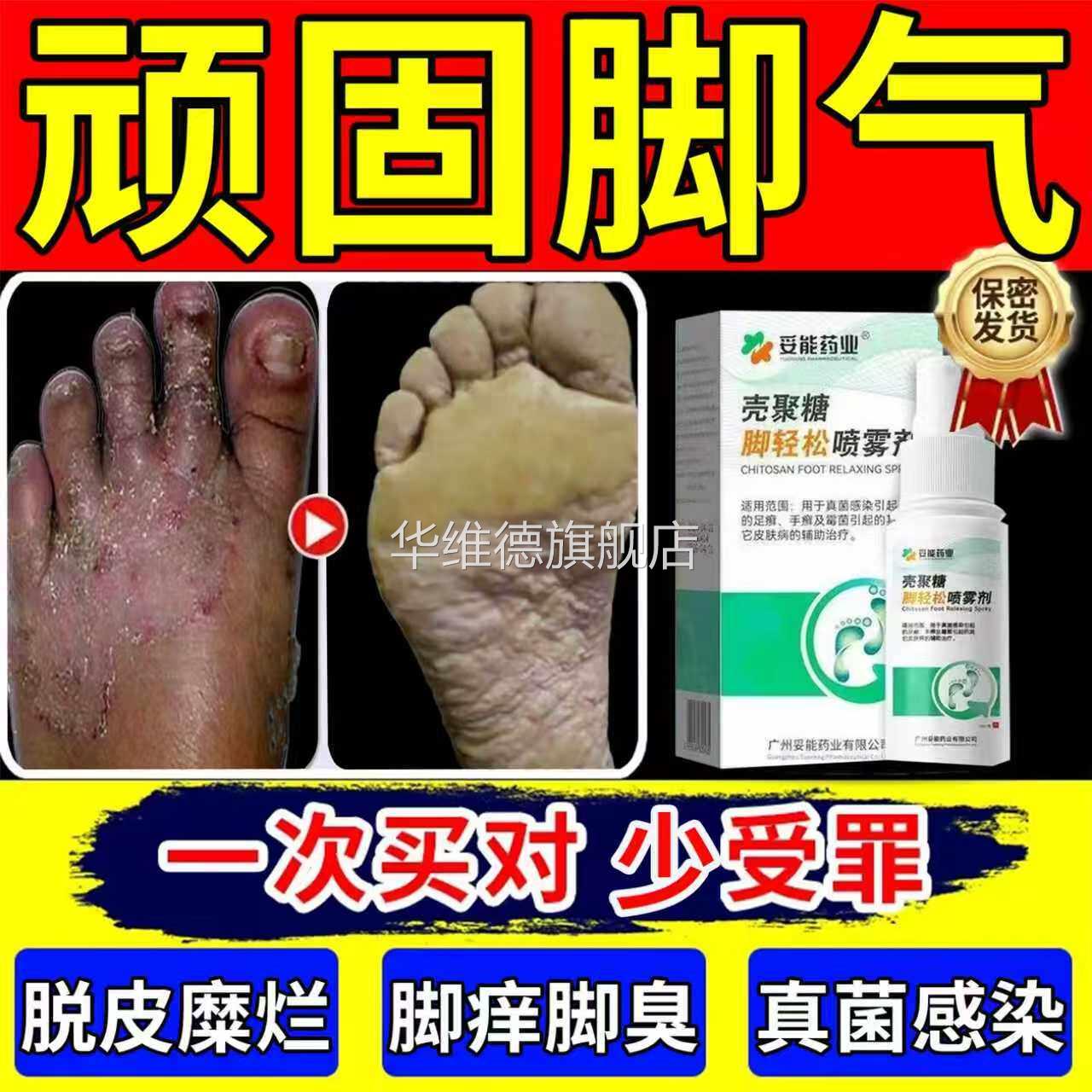 喷脚王治疗脚气脚痒止痒脱皮杀菌根去除专用特效膏狼毒官方旗舰店