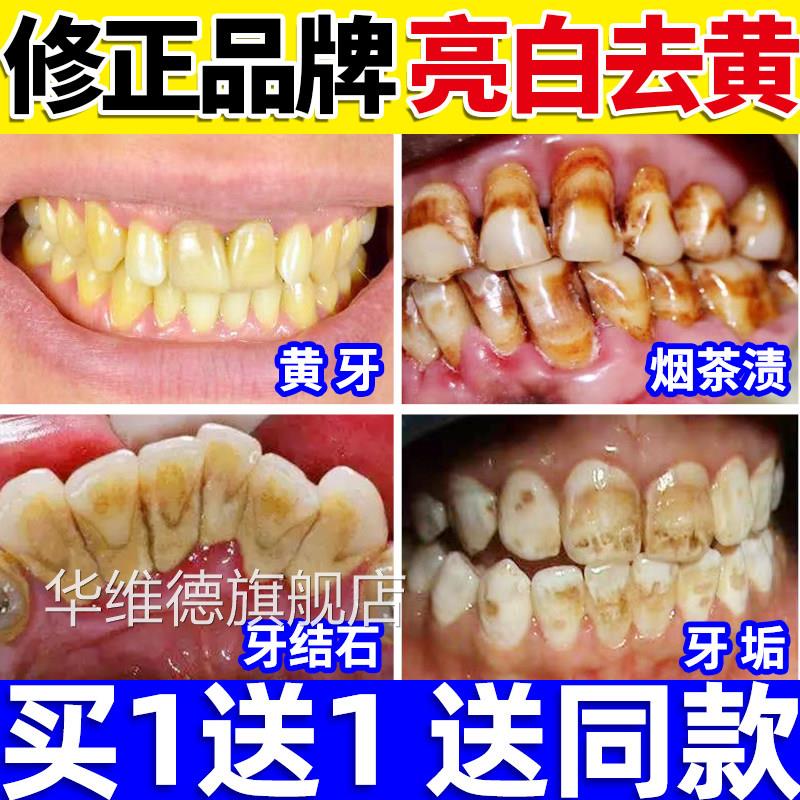 洁牙粉可搭去黄洗白牙齿美白黄洗污垢去牙结石神器牙除牙垢牙烟渍
