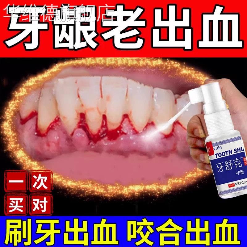 云南白药牙膏牙周炎牙龈出血专用牙膏喷剂牙龈脓包肿痛消炎脱敏UU