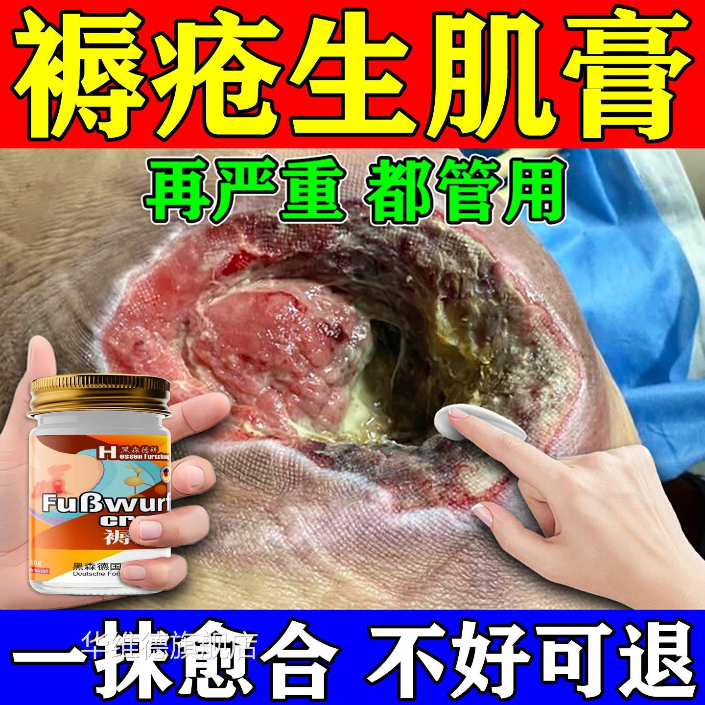褥压疮肉特老人臀部外用卧床瘫痪伤口愈合快速结痂促进长生肌膏华
