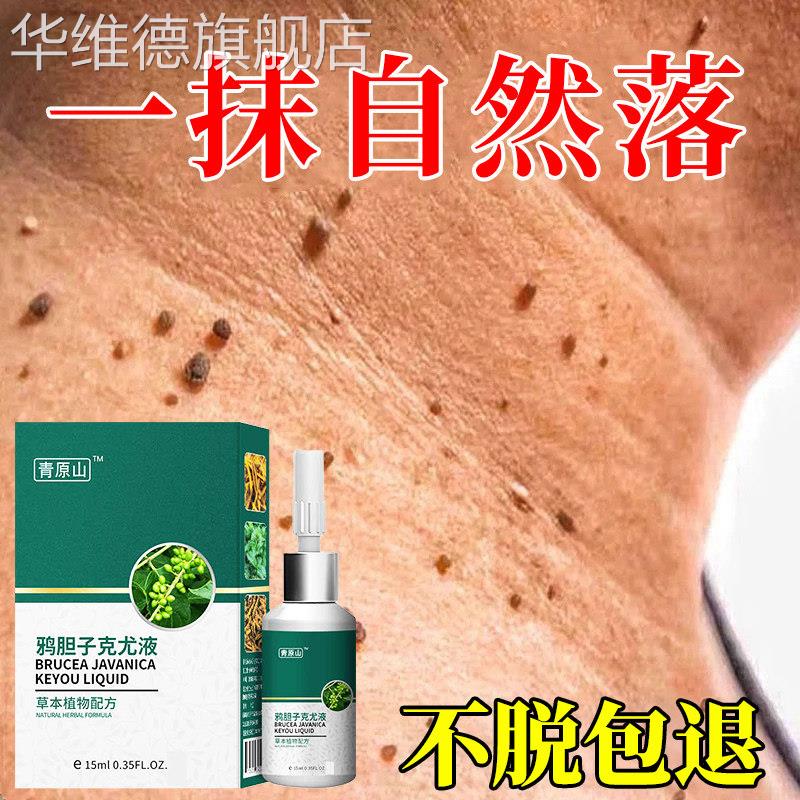 扁平疣瘊子去除软膏一抹灵去脖子上长小肉粒疙瘩丝状疣专用点疣膏