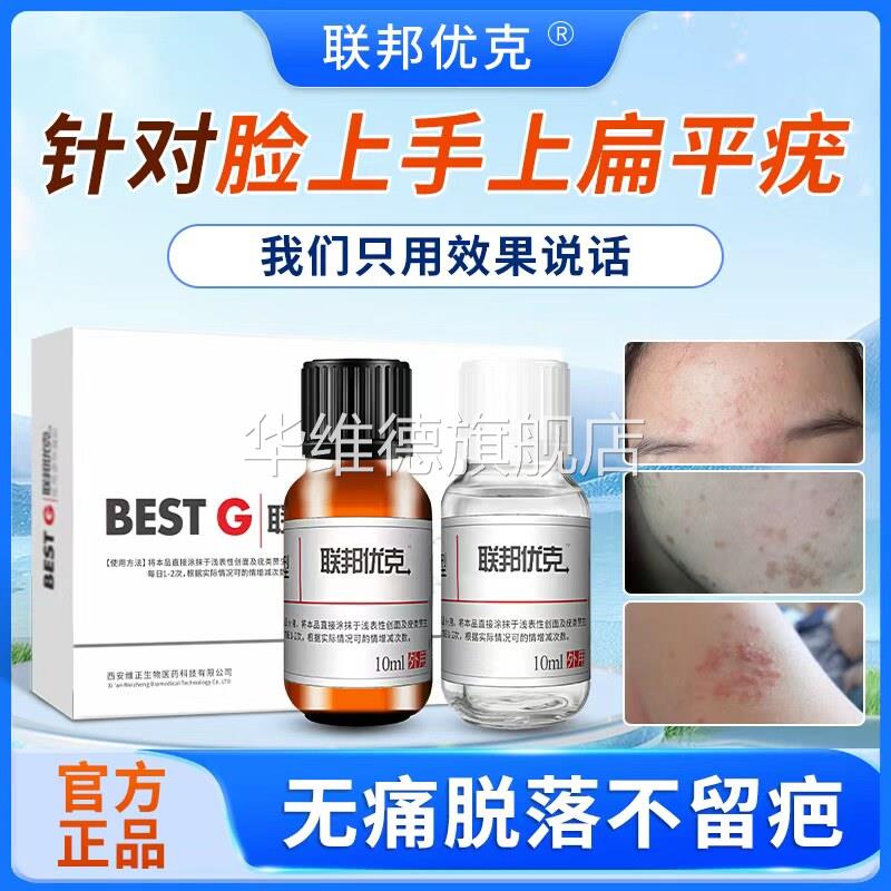 扁平疣专用去除软膏尤瘊一抹灵脖子长小肉粒丝状尖锐湿疣神器无忧