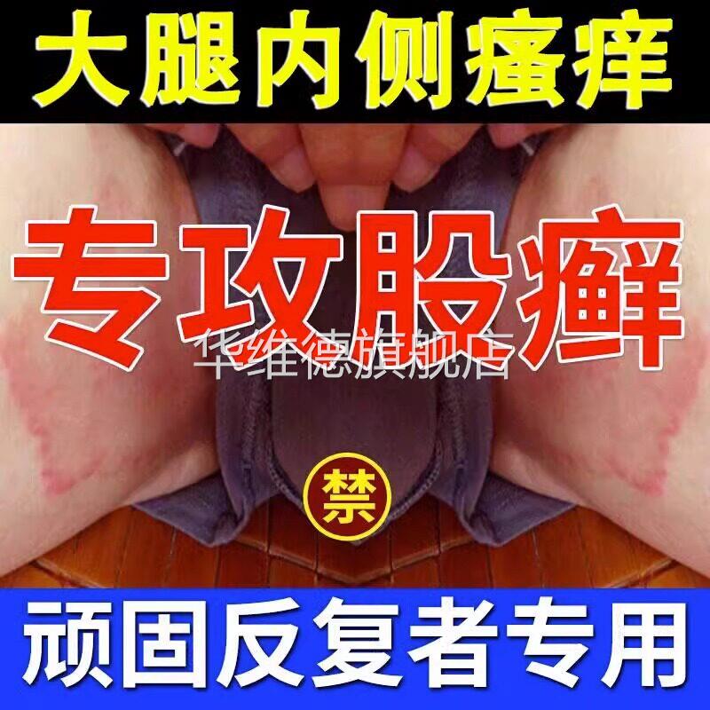 股藓大腿内侧根皮肤瘙痒真菌感染牛皮癣药体股癣去湿疹屁股止痒膏