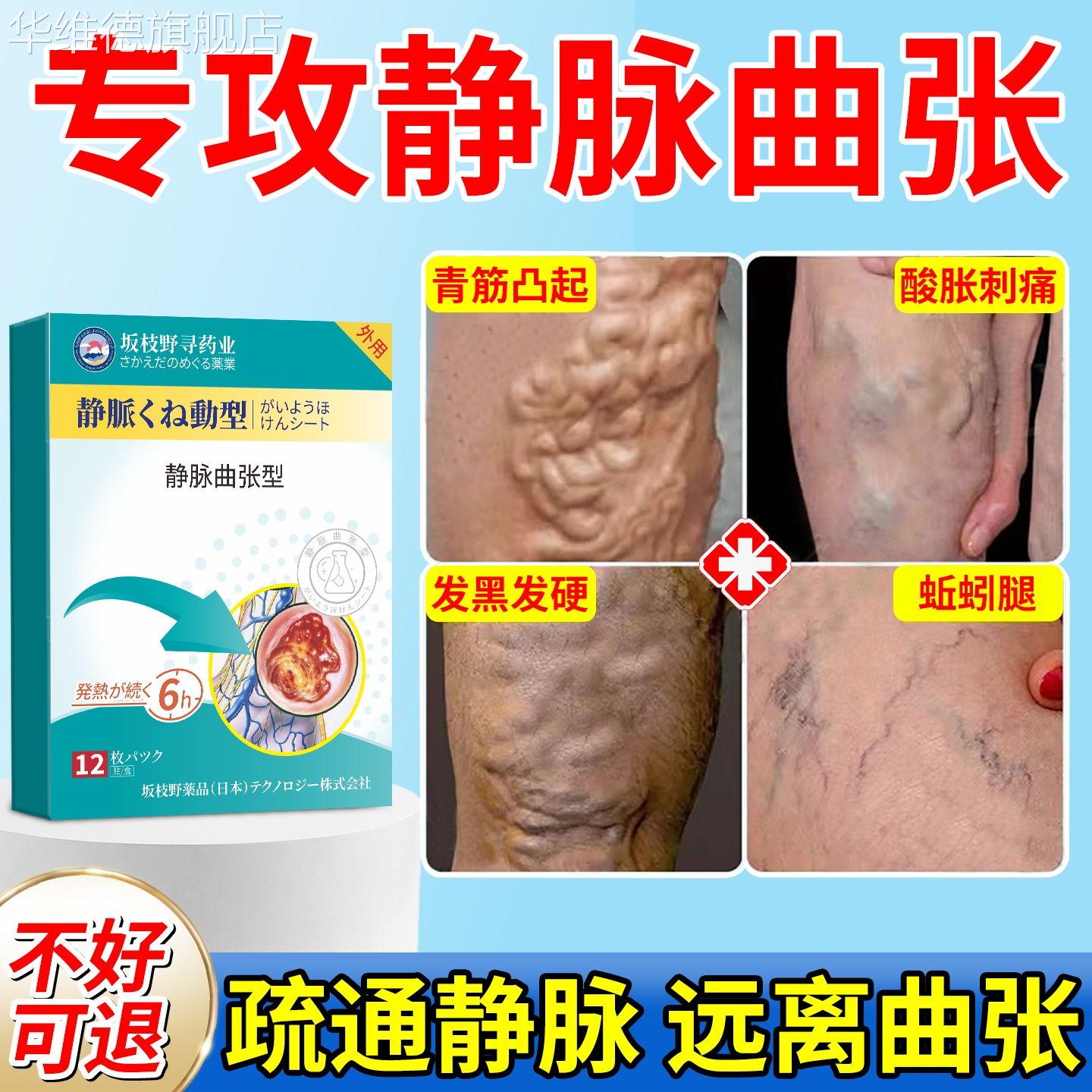 日本医用静脉曲张冷敷凝胶薬膏蚯蚓腿部青筋凸起官方正品专用特效