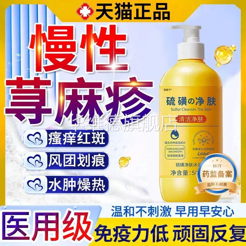过敏性慢性胆碱性寻荨麻疹过敏止痒根提高免疫力止痒膏硫磺沐浴露