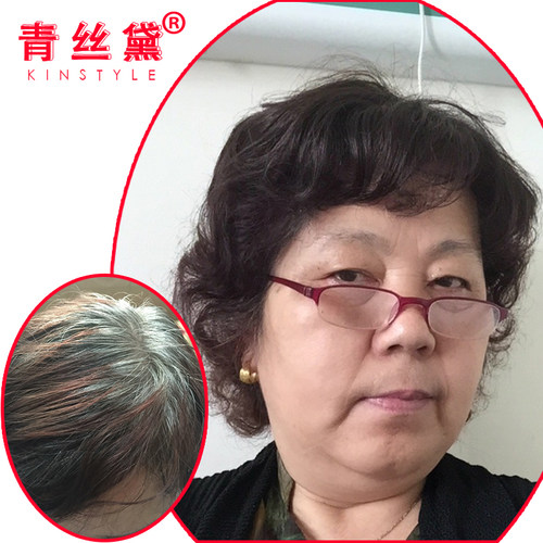 青丝黛假发蓬松头顶无痕遮白真发补发片蓬松女薄短卷发隐形补发块