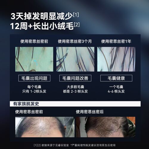 密思丝密防脱安瓶 30支Foliculo生发精华适用所有发质