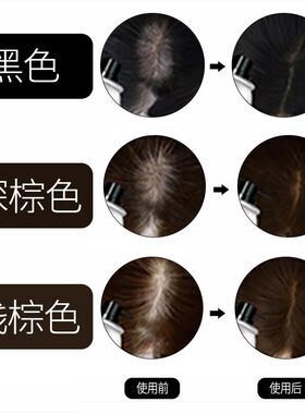 纯植物头发密发增发纤维粉喷雾发际线粉快速补发神器遮秃头顶男女