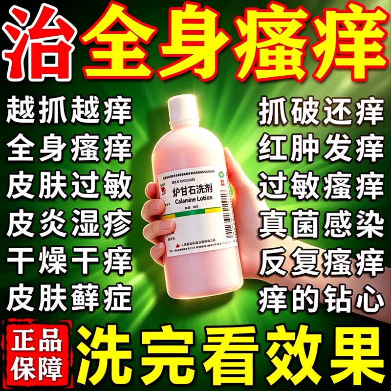 炉甘石洗剂正品官方外用湿疹止痒特药效皮肤瘙痒湿疹含氧化锌甘油