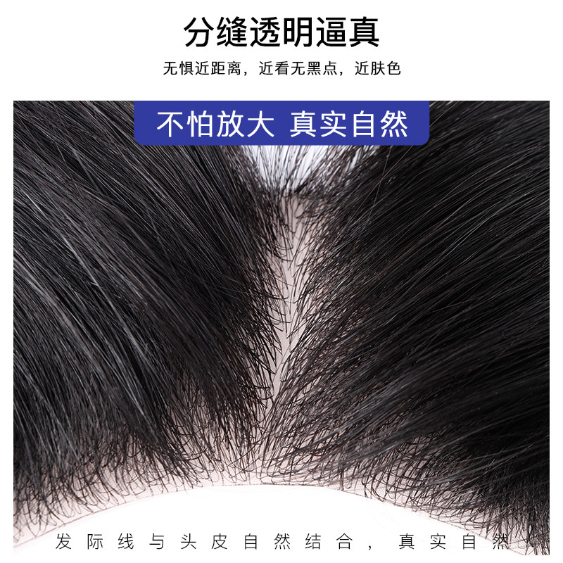 发际线假发贴男士前额生物头皮补发片真人发丝m型额头斜刘海逼真