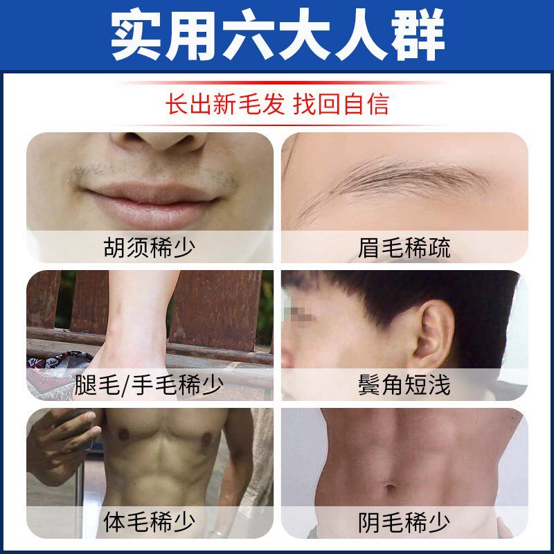 落健头发增长液浓密男毛发长胡子浓眉毛发际线络腮胡生长精华神器