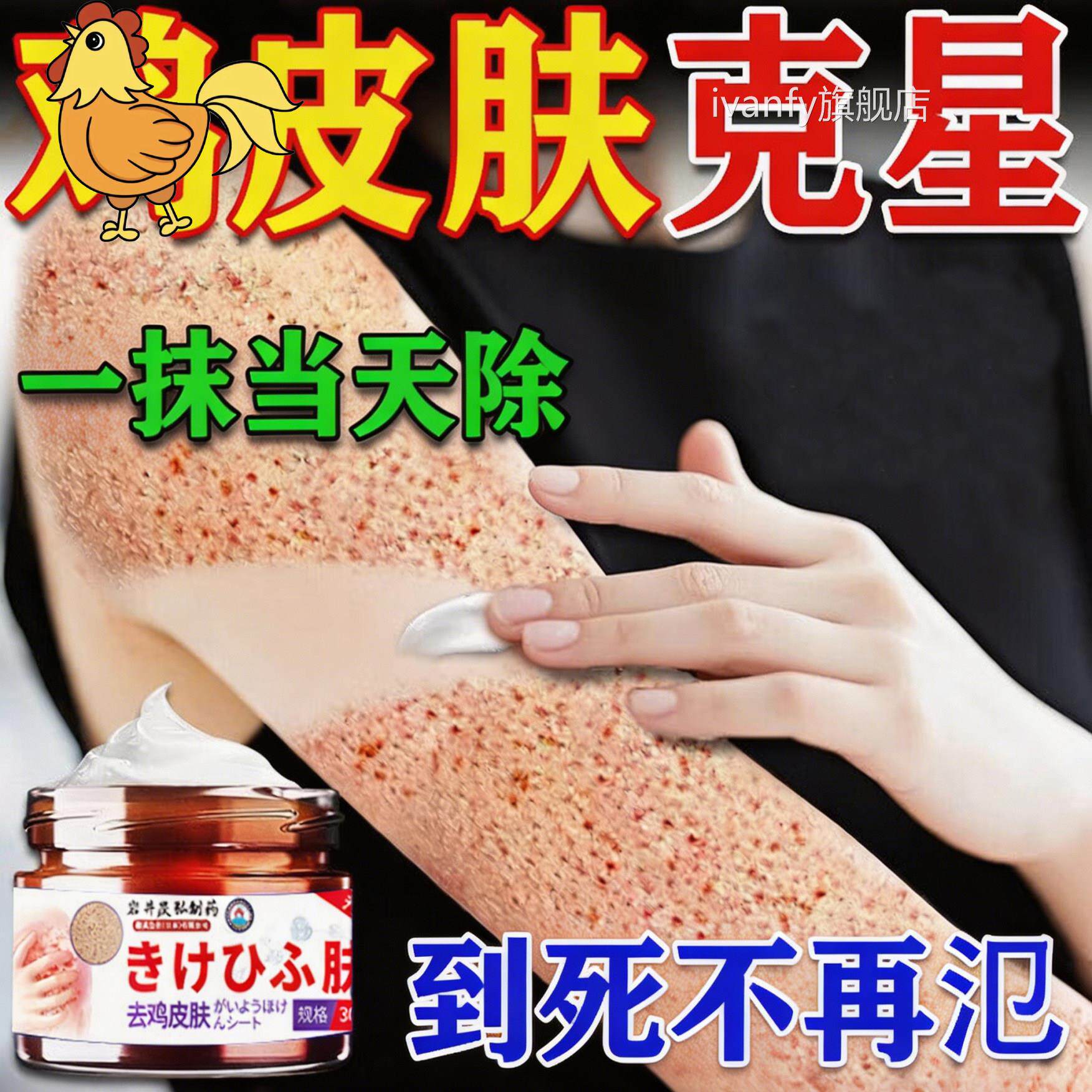 鸡肤皮疙瘩毛囊角化症用去全除身臂腿背部专毛孔堵塞疏神器通膏药