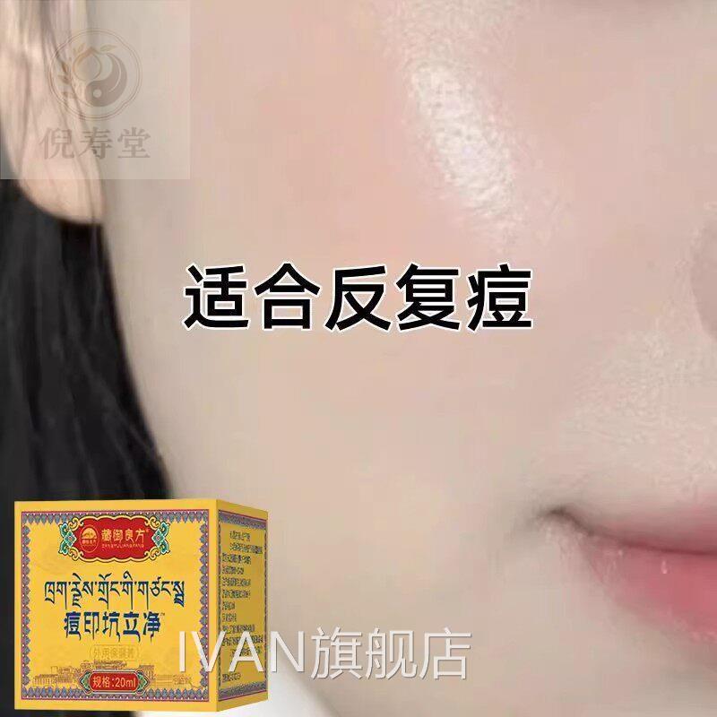 正品立素祛痘膏痘立消痘克清祛痘疤痘凹洞痘坑痘根净痘立净w2IVAN