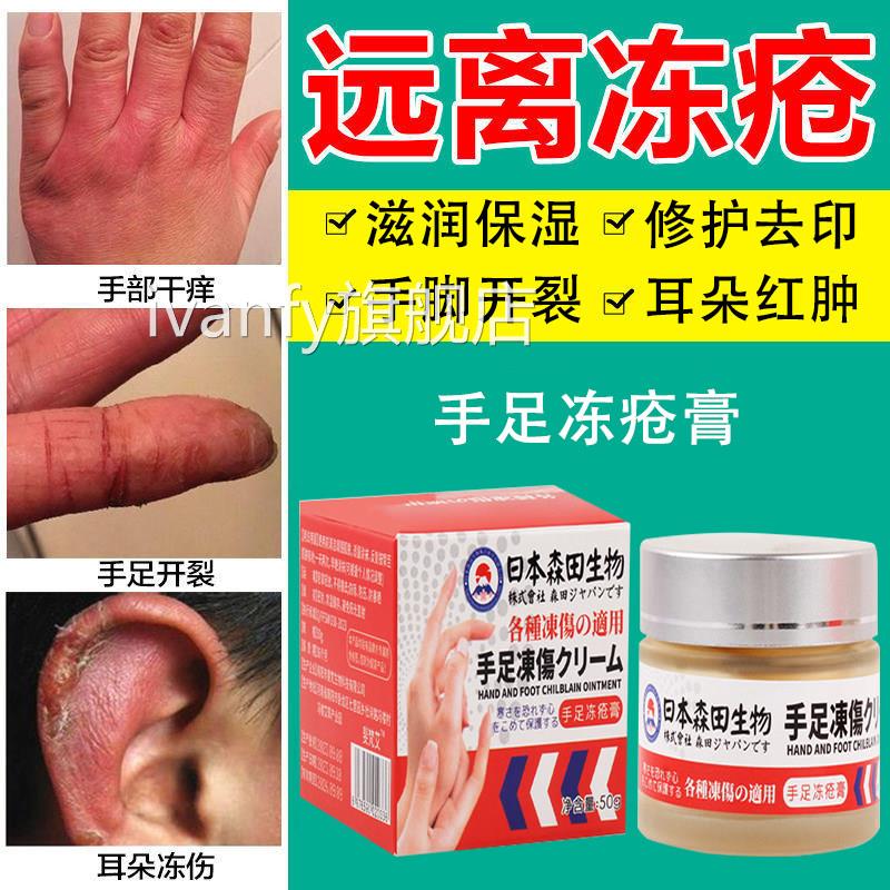 冻疮膏止痒冻痒伤膏药正品防裂膏防冻冻手足耳朵红肿日本特效ivan