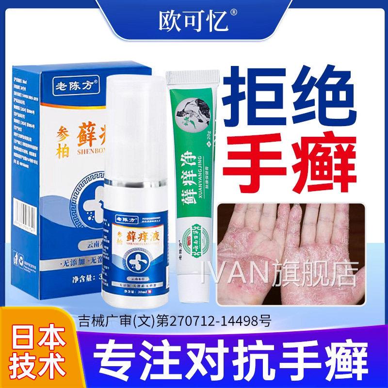 手癣膏脱皮手指手肘关节癣干 肤干裂去止痒真菌感染皮病鹅掌风烂