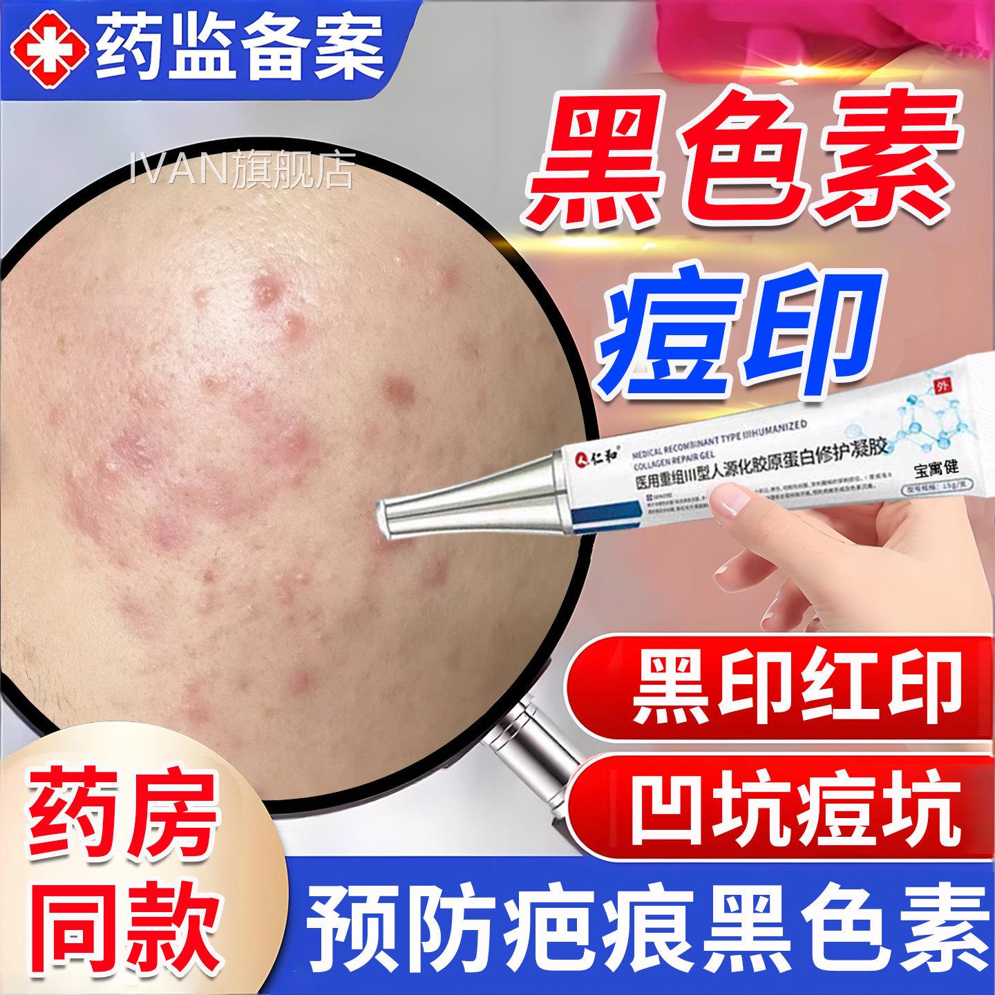 痘印黑色素沉淀去除黑印红印痘坑修复化男医用型淡痤疮疤痕青少年