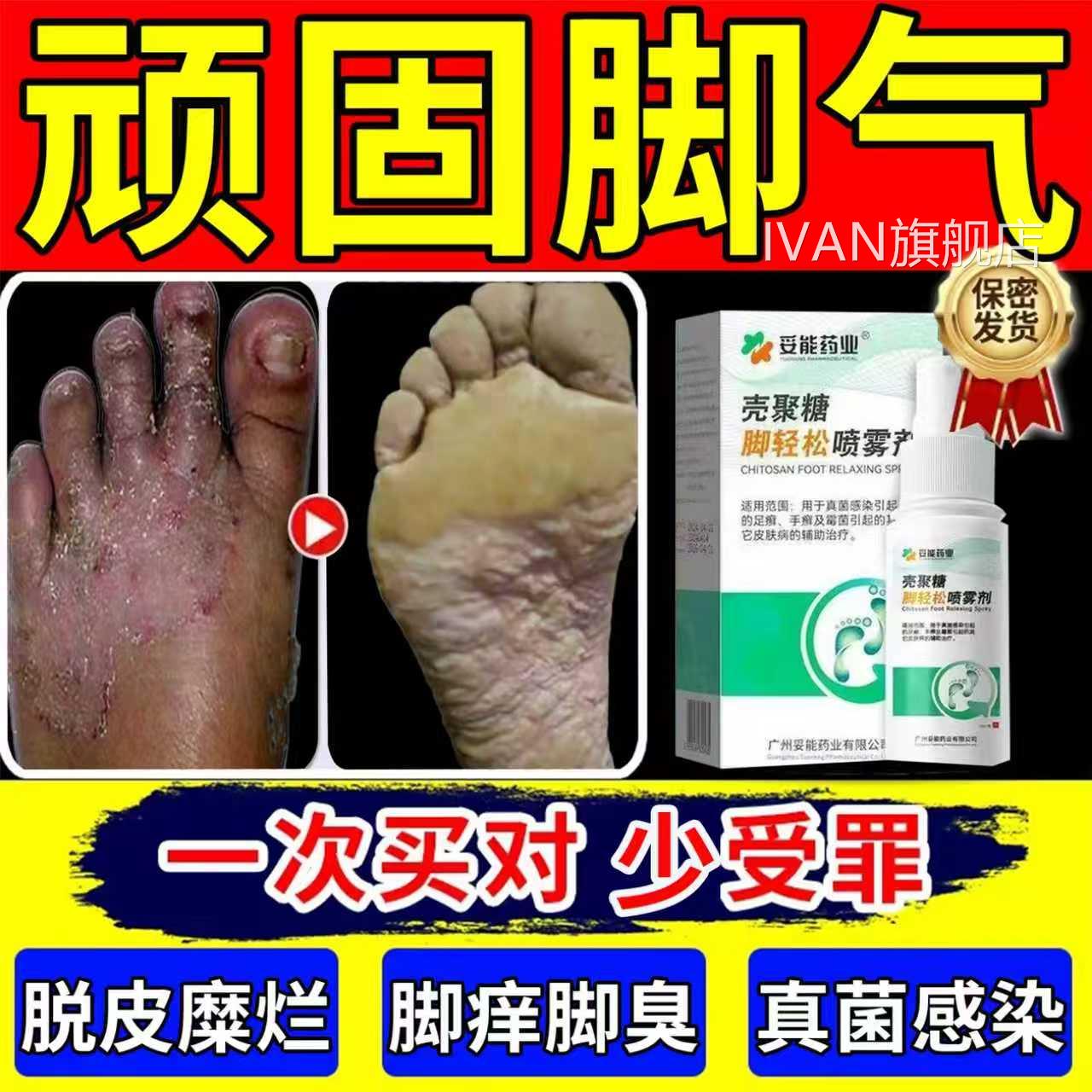 喷脚王治疗脚气脚痒止痒脱皮杀菌根去除专用特效膏狼毒旗官方舰店