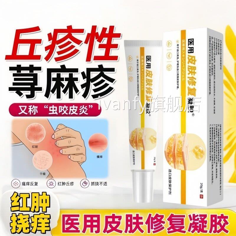 丘疹性荨麻疹复】湿疹风痒荨麻疹湿热痒抓挠红肿 医用皮肤修凝胶i