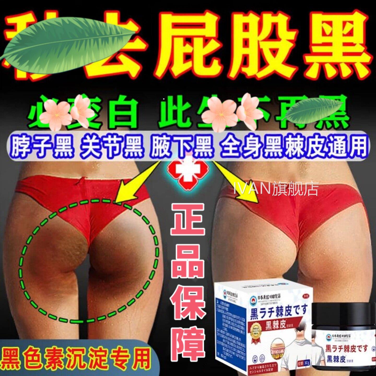 日本脖大腿内侧黑色素沉子淀去除屁股祛坐印臀部发黑坐茧黑棘皮膏