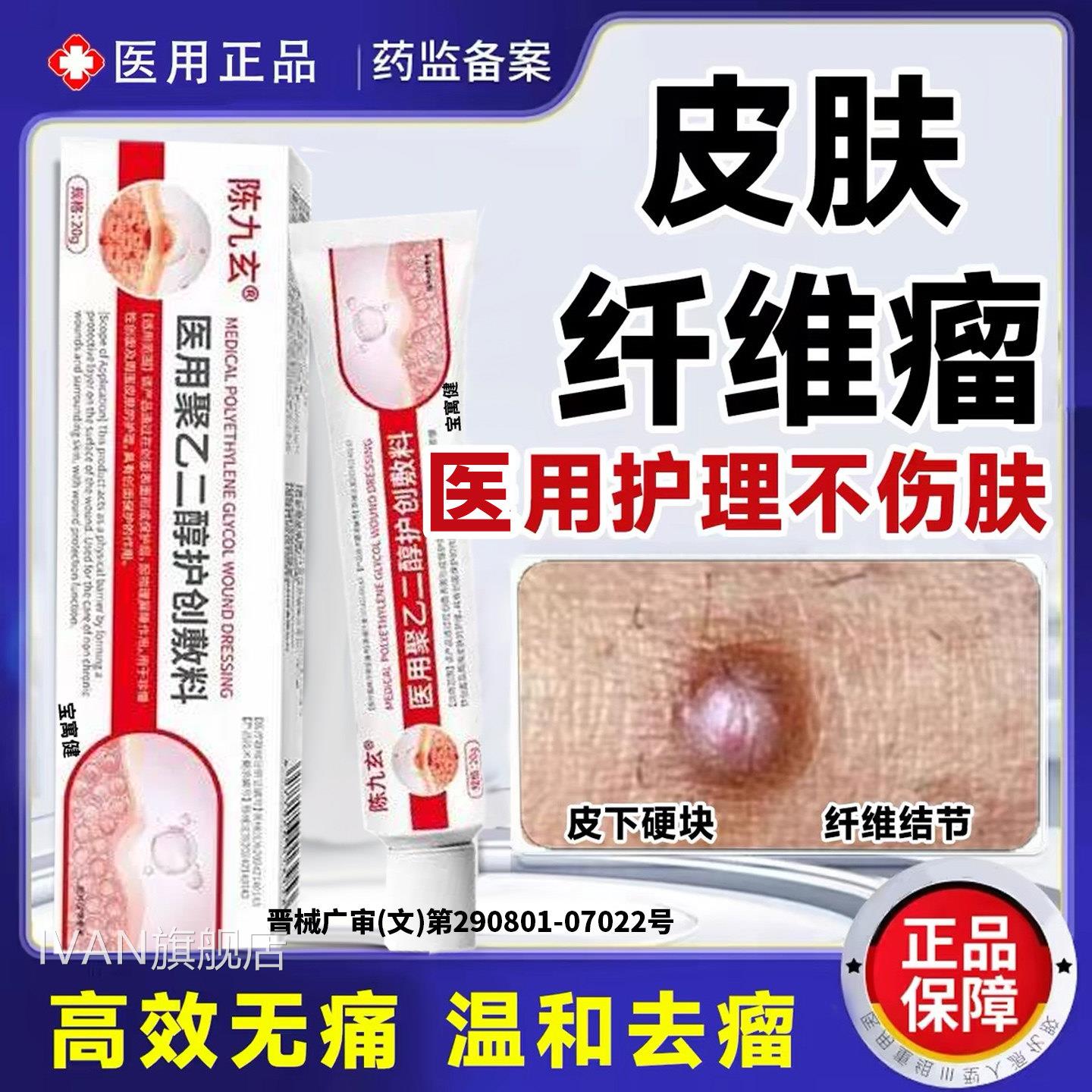 陈九玄脂瘤消瘤肪膏去除神器皮下硬块皮肤纤维脂腺囊肿官方旗舰店
