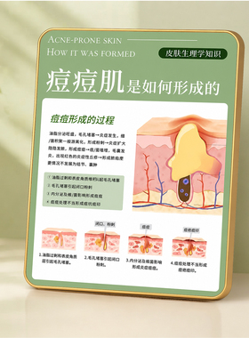 痘痘肌形成科普装饰摆台美容院皮肤管理店桌面装饰摆件
