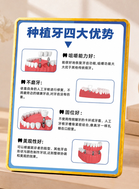 牙科门诊种植牙四大优势宣传展示牌口腔诊所桌面装饰摆件