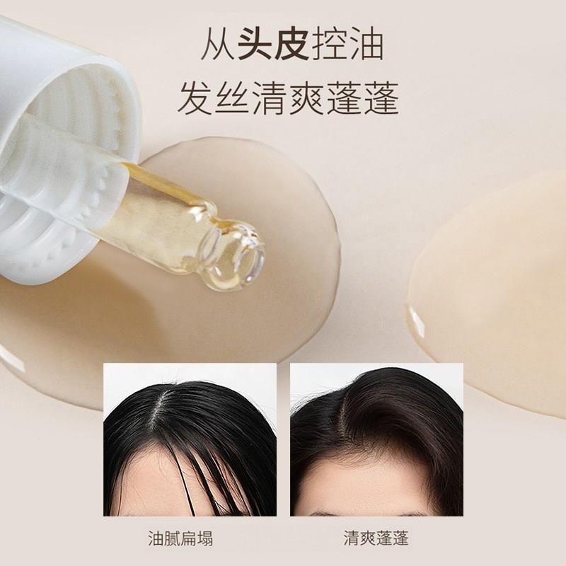 菲诗蔻头皮护理精华液油控油保湿敏感修护舒缓清爽女护发免洗安瓶