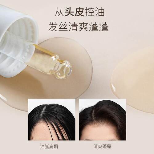 菲诗蔻头皮护理精华液油控油保湿敏感修护舒缓清爽女护发免洗安瓶