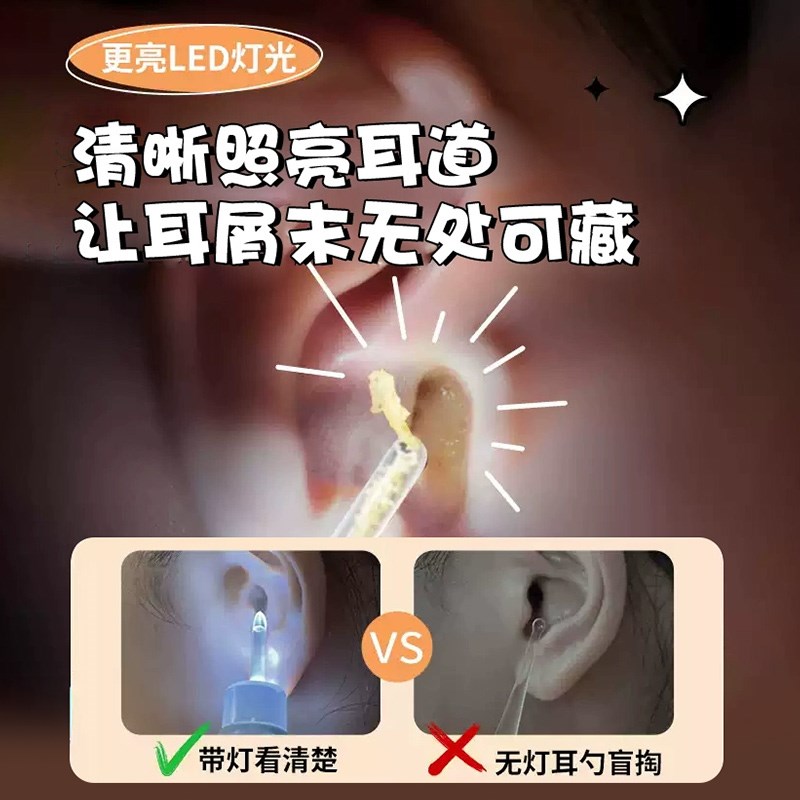 2025升级家用可视挖耳勺儿童宝宝专用带灯发光吸耳屎镊子护理耳道
