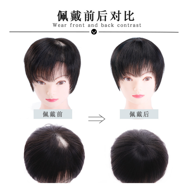 头顶遮白发假发片真发头顶补发片女一片式轻薄无痕自然短发补发块