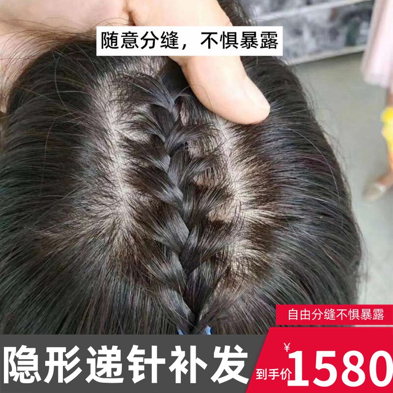 头顶织发补发片式翻盖假发神器无痕递针男隐形生物头皮自然短发