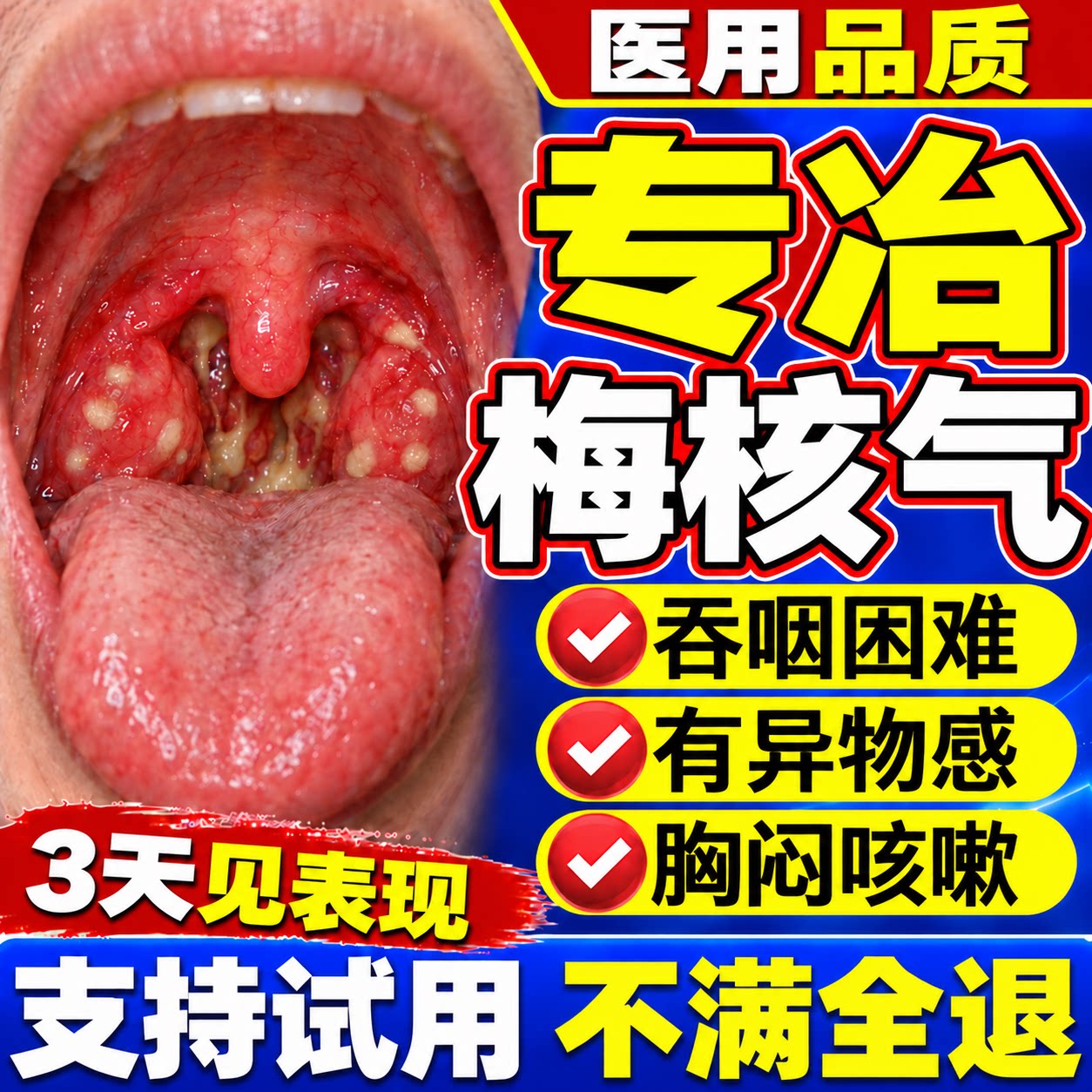 梅核气专用膏药喉咙有异物感咽喉肿痛慢性发炎嗓子痰多吐完不反贴
