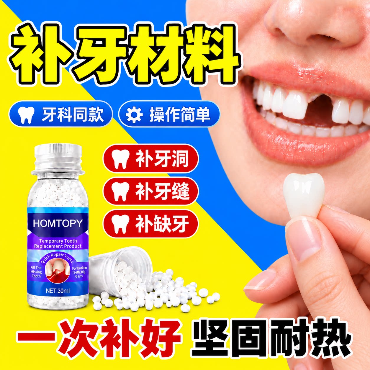 补牙齿洞填补膏材料自在己家填充