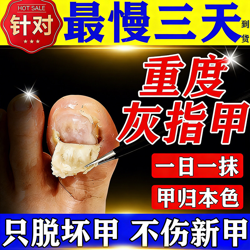 灰指甲特专用效药根第治名一脱甲真菌感染环吡酮胺乳膏官方旗舰店