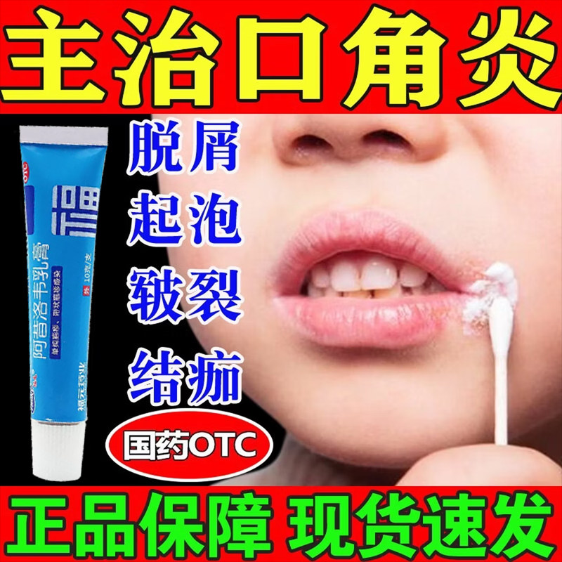 嘴角开裂烂口角炎药膏阿昔洛韦乳膏正品特带状单纯疱疹效专用药膏