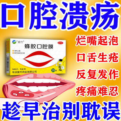 紫竹蜂胶口腔膜正品官方旗舰店20片清热止痛用于复发性口疮治口疮