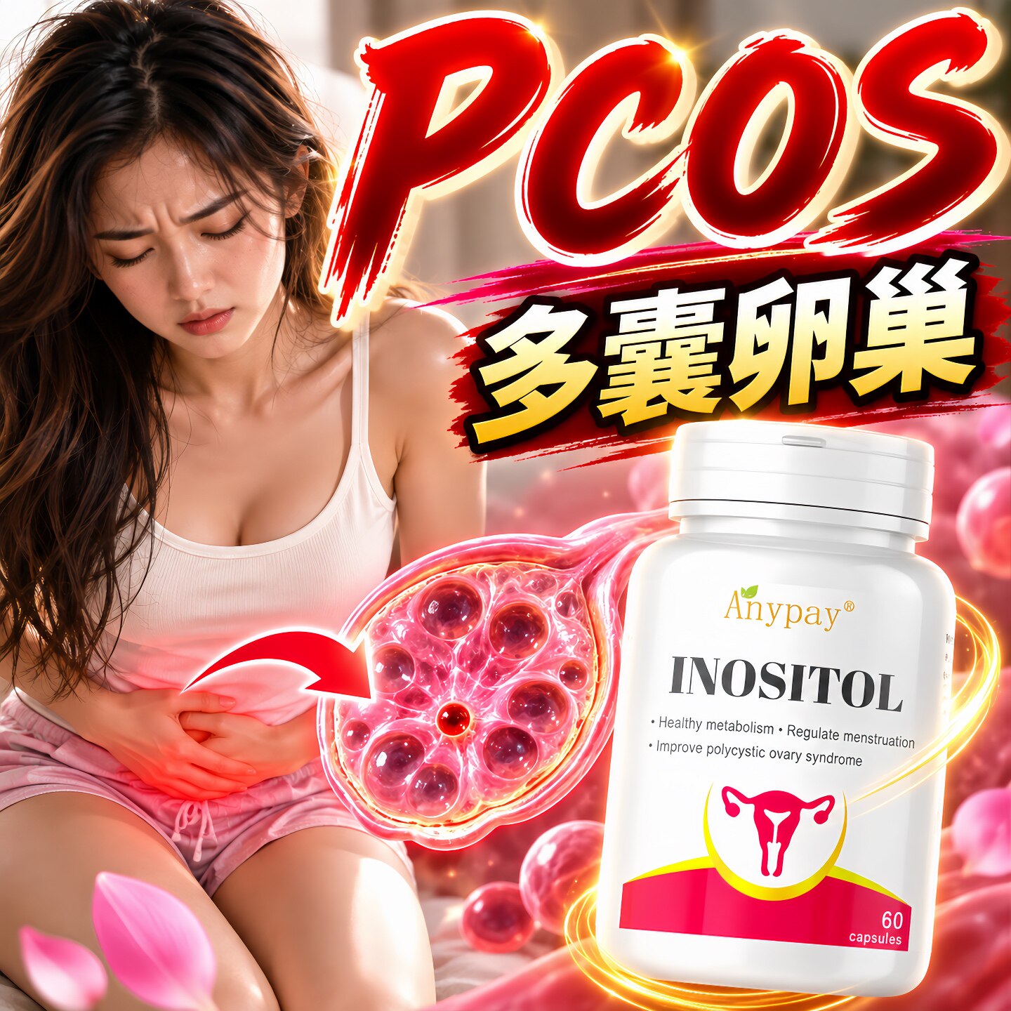 多囊卵巢综合征内分泌促排助备孕