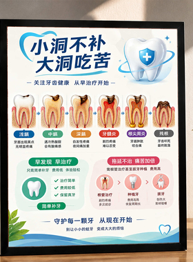 牙科诊所口腔健康宣传带框挂画蛀牙发展流程诊室墙面装饰摆画
