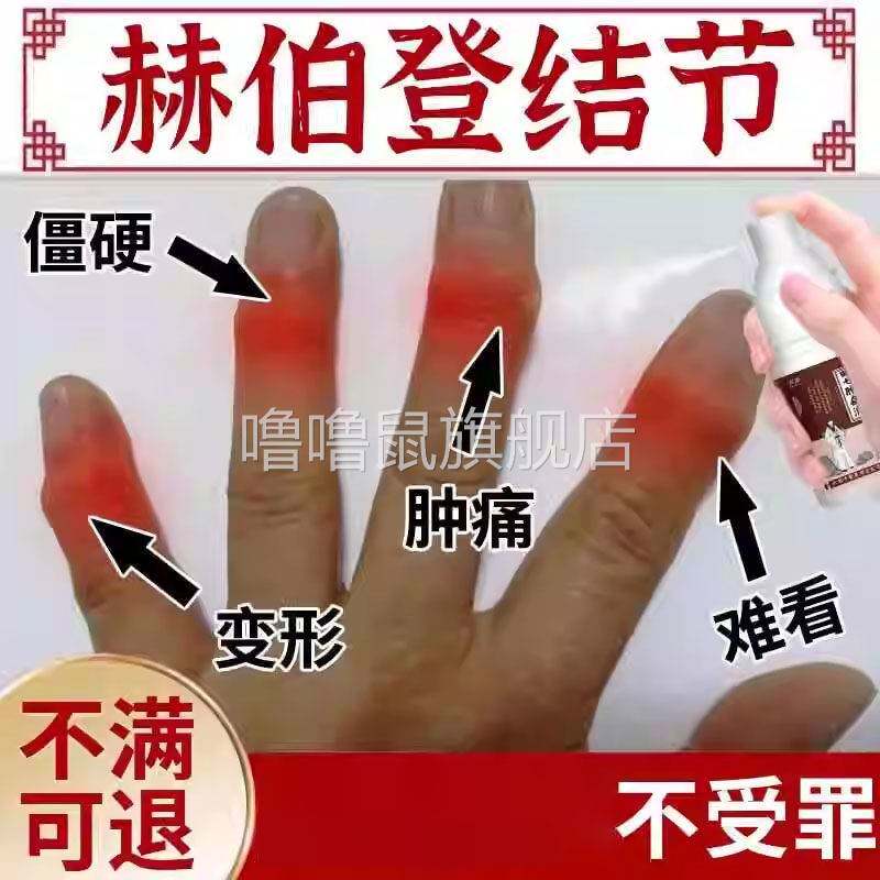 噜噜鼠正品手指赫伯登结节专用膏药贴无菌性骨关节炎疼痛消肿薬房