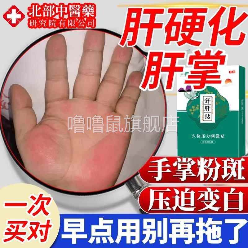 噜噜鼠正品肝掌手发红肝硬化引起慢性手掌肝炎专用粉红色斑块膏药