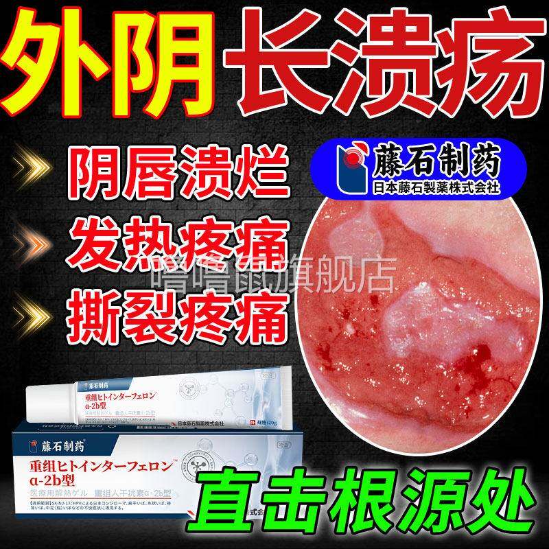噜噜鼠正品外阴溃疡药膏私处破皮粘膜溃破疼痛白斑瘙疱疹有小疙瘩