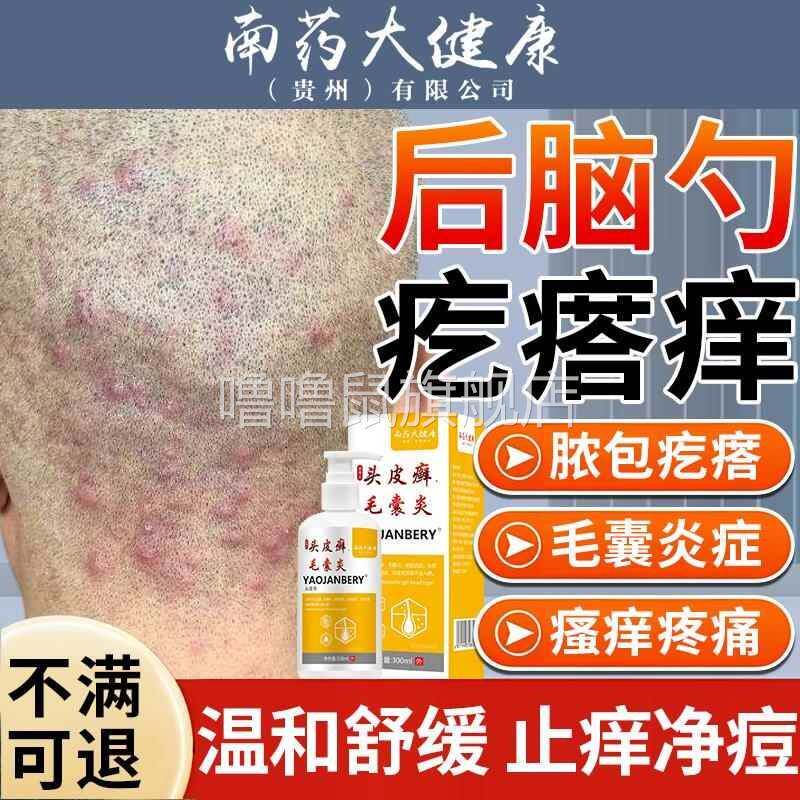噜噜鼠正品头皮毛囊炎红痘疙瘩专用脂溢性皮炎真菌感染喷雾剂药房